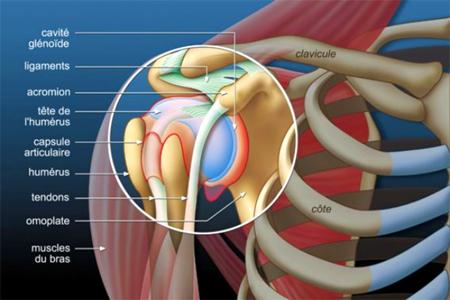 Traitement arthroscopique calcification épaule Paris Tunisie