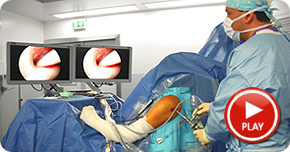 video-chirurgie-arthroscopie-paris
