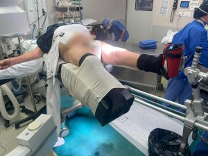 blo-operatoire-preparation-prothese-de-hanche-mini-invasive-paris